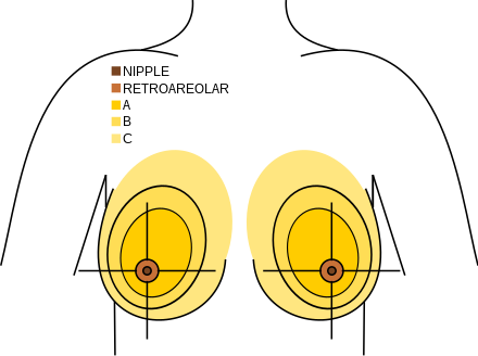 Quadrants of breast.