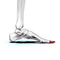 Distal phalanges of left foot03 medial view.png