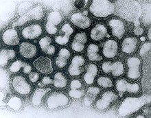 Transmissionselektronmikrograf af influenza A -vira (lyse genstande på en mørk baggrund).