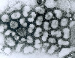 A형 인플루엔자 바이러스의 전자현미경 사진