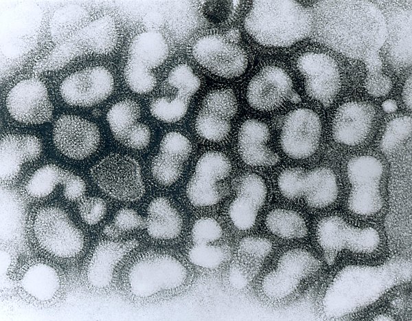 Transmission electron micrograph (TEM) of negatively stained Influenza A virus particles (small and white) attached to host cells (large and irregular