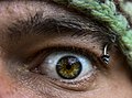 MPOTY 2015 The Heroin Highway dilated eye close up.jpg