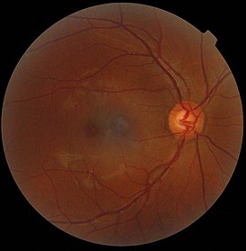 Fotografía de la retina de un ojo humano.