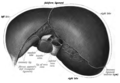 Brániční plocha jater s vyznačeným appendix fibrosa hepatis ("fibrous appendix")