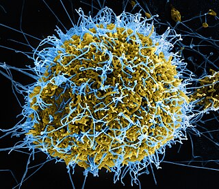 <span class="mw-page-title-main">Post-Ebola virus syndrome</span> Sequelae following recovery from Ebola virus disease