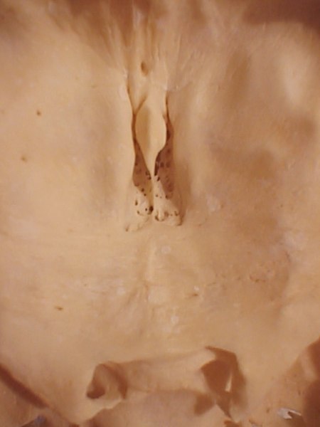 File:Ethmoid crista galli.jpg