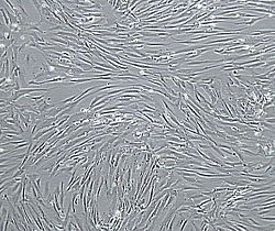 Menselijke aorta SMC.jpg