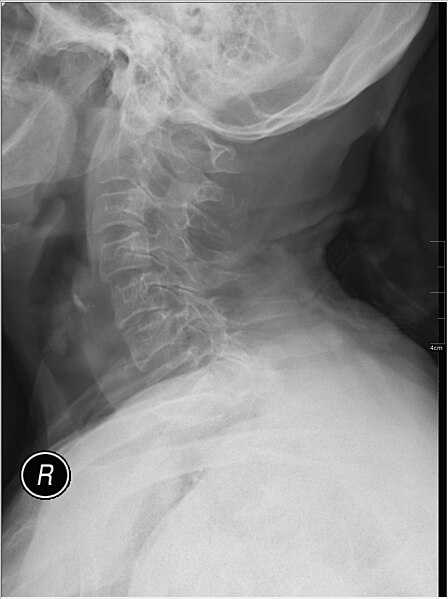 File:Medical X-Ray imaging CET03 nevit.jpg