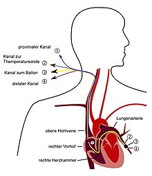 Pulmonary artery catheter german.jpg