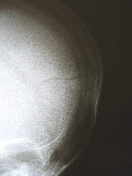 File:Radiology 1300330.JPG