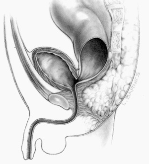 Analatresie: Geschichte, Häufigkeit, Diagnose