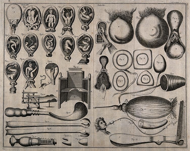 File:The examination of the uterus, the natural posture of a chil Wellcome V0016325.jpg