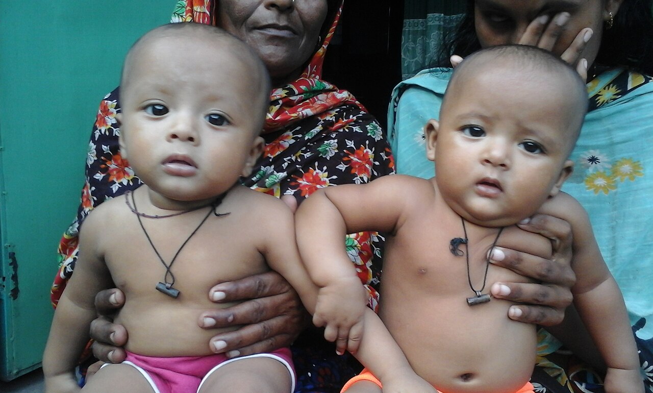 File:Twins baby bd 2.jpg - Wikimedia Commons