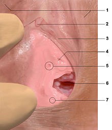 תרשים המתאר את המיקום האנטומי של בלוטת סקין: 1) השפתיים הגדולות, 2) דגדגן, 3) השפתיים הקטנות, 4) השופכה, 5) בלוטת סקין, 6) הנרתיק, 7) בלוטת ברטולין
