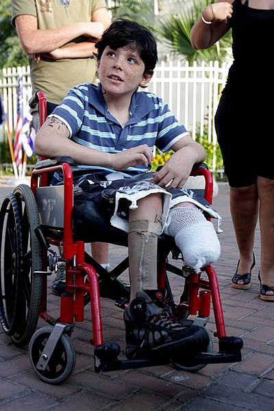 File:9-years old Israeli boy Osher Twito copes with lost of his leg after Qassam exploded next to him in Sderot Israel.jpg