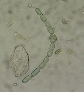 Opis obrazu Anabaena20151208152159.JPG.