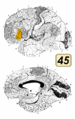 ブロードマンの脳地図における45野