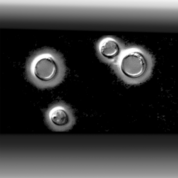 File:Cryptococcus neoformans.png