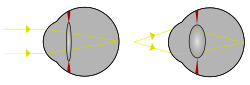 Enfoque en un ojo.svg