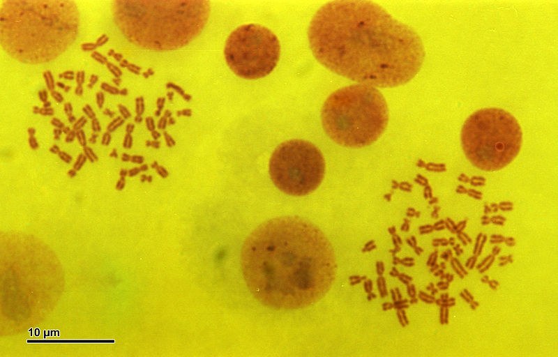 File:Human karyotype (263 17) Karyotype Human, 45,XY t13-14.jpg