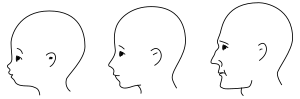 Change of head proportions (especially the relative size of the maxilla and mandible) as a function of age Kopfproportionen.svg