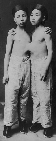 File:Korean Siamese twins 1903.jpg