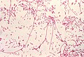 LegionellaPneumophila Gram.jpg