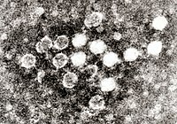 papiloma virus b19)