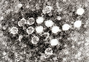 Micrographia electronic de Erythroparvovirus primate1 in sanguine.