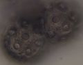 Silene flos-cuculi Kuckucks-Lichtnelke Pollen 400x.jpg