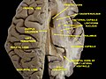 Ventricles of brain and basal ganglia. Superior view, horizontal section, deep dissection