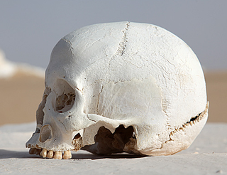 <span class="mw-page-title-main">Occipital bone</span> Saucer-shaped membrane bone situated at the back and lower part of the cranium