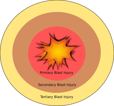 File:Anatomy of a Blast.svg