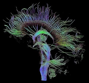 Людьскый мозоґ зображеный техніков діфузной маґнетічной резонанції.