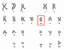 Human male karyotpe high resolution - Chromosome 10.png