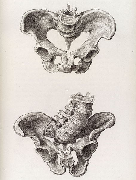 File:Illustration of a deformed female pelvis - angular distortion Wellcome L0038229.jpg