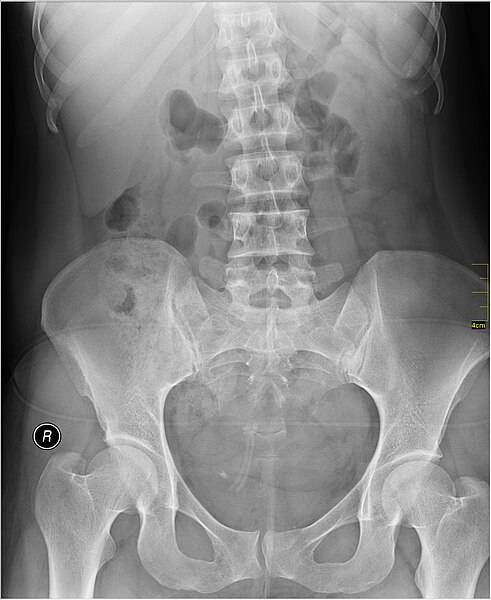 File:Medical X-Ray imaging CCC03 nevit.jpg