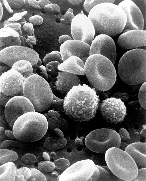 A scanning electron microscope image of normal circulating human blood. One can see red blood cells, several knobby white blood cells including lympho