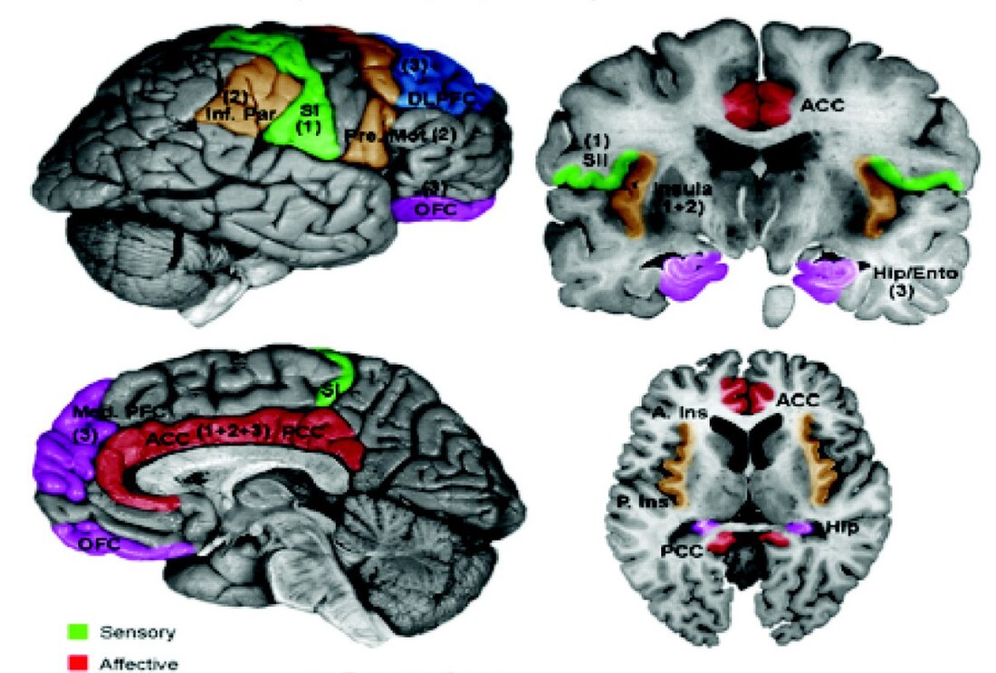 Secondary somatosensory cortex