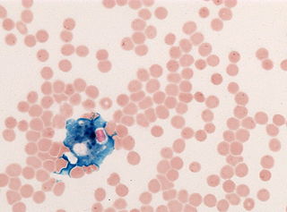 <span class="mw-page-title-main">Perls Prussian blue</span> Histologic method to stain for iron