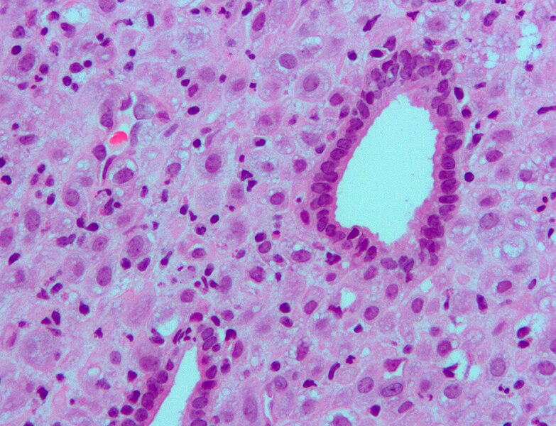 File:Endometrium ocp use3.jpg