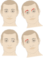 Eye rotation diagrams.svg