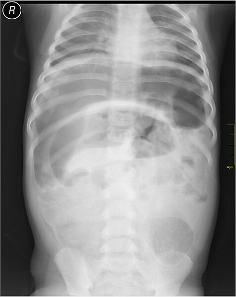 File:Medical X-Ray imaging OIP06 nevit.jpg