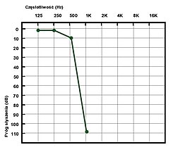 PDCI audiogram.jpg