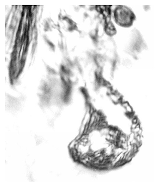 File:Paleotrypanosoma burmanicus.jpg