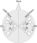 Thumbnail for File:Semicircular Canals.png