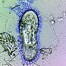 Paramecium tetraurelia, a ciliate, with discharged trichocysts (artificially colored in blue). Trichosyst.jpg