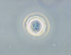 Fazni mikrograf Acanthamoebae polyphagae u obliku mikrobne ciste.