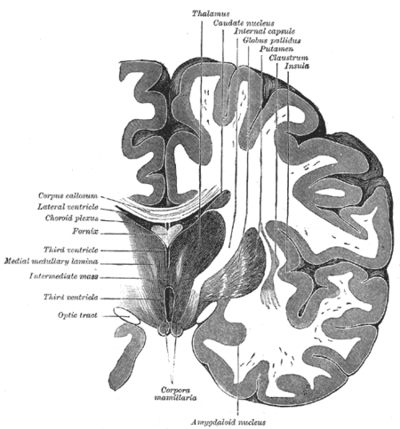 مقطع جبهي في الدماغ خلال الكتلة المتوسطة للبطين الثالث.
