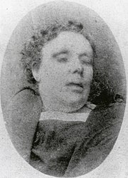 Mortuary photograph of Chapman: a middle-aged woman with short, curly hair
